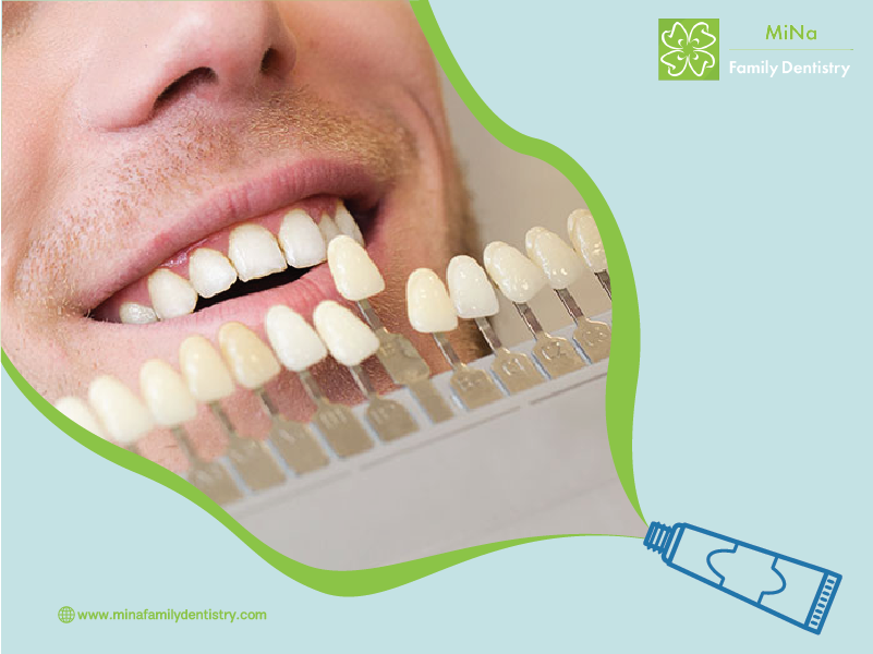 Dentist comparing veneer shades to find the perfect match for a patient's smile