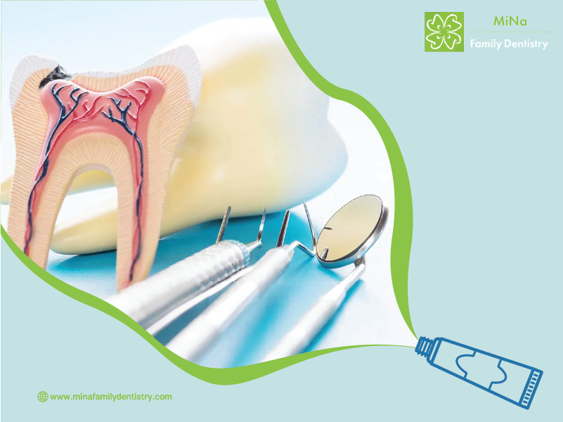 Digital X-ray and root canal anatomy illustration used at MiNa Family Dentistry, Thornhill